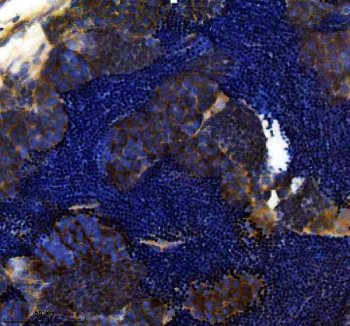 Zebrafish RAD51 Antibody Testis IHC. Immunohistochemical analysis of RAD51 expression using anti-RAD51 antibody in paraffin embedded zebrafish testis tissue. RAD51, also known as RAD51 Recombinase, is a central mediator of homologous recombination and DNA double strand break repair that plays an essential role in meiotic chromosome segregation and germ cell maintenance. Prominent staining is observed within seminiferous structures, consistent with the high DNA repair activity associated with spermatogenesis. Heat mediated antigen retrieval was performed in EDTA buffer prior to staining. Sections were blocked with 10 percent goat serum and incubated with RAD51 antibody at 2 ug/ml overnight at 4 degrees Celsius. Detection was achieved using a peroxidase conjugated goat anti rabbit IgG secondary antibody and DAB chromogen. These results support the utility of Zebrafish RAD51 Antibody for studies of meiosis, genome stability, reproductive biology, and DNA damage responses.