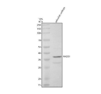 Zebrafish RAD51 Antibody Embryo WB. Western blot analysis of RAD51 expression using anti-RAD51 antibody. RAD51, also known as RAD51 Recombinase, is a key mediator of homologous recombination and DNA double strand break repair that maintains genomic stability during development. Lane 1: zebrafish embryo tissue lysate. A specific band was detected at approximately 38 kDa. Although the predicted molecular weight of RAD51 is approximately 26 kDa, slower migration has been reported and may reflect post translational modifications, oligomerization, or species specific differences in electrophoretic mobility. These results demonstrate expression of RAD51 in zebrafish embryos and support the utility of this antibody for studies of DNA repair, genome maintenance, and developmental biology.