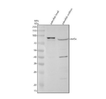 Zebrafish STAT5A Antibody WB. Western blot analysis of STAT5A expression using anti-STAT5A antibody. STAT5A, also known as Signal Transducer And Activator Of Transcription 5, is a cytokine responsive transcription factor that mediates JAK STAT signaling and regulates cellular growth, differentiation, and immune responses. Lane 1: zebrafish head tissue lysate. Lane 2: zebrafish embryo tissue lysate. A major band was detected at approximately 87 kDa, corresponding to the expected molecular weight of STAT5A. An additional band at approximately 43 kDa was observed in embryo lysates and may represent a proteolytic fragment, alternatively spliced isoform, or processed form of Signal Transducer And Activator Of Transcription 5. These results demonstrate expression of STAT5A in zebrafish tissues and support the utility of this antibody for studies of cytokine signaling, hematopoiesis, and developmental biology.