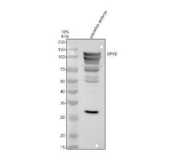 Zebrafish DPYD Antibody WB. Western blot analysis of DPYD using anti-DPYD antibody. Electrophoresis was performed on a 10% SDS-PAGE gel for 2 hours. The sample well of each lane was loaded with 30 ug of sample under reducing conditions. Lane 4: zebrafish embryo tissue lysates. After electrophoresis, proteins were transferred to a nitrocellulose membrane at 150 mA for 50-90 minutes. Blocked the membrane with 5% non-fat milk/TBS for 1.5 hour at RT. The membrane was incubated with rabbit anti-DPYD antigen antibody at 0.5 ug/ml overnight at 4oC, then washed with TBS-0.1%Tween 3 times with 5 minutes each and probed with a goat anti-rabbit IgG-HRP secondary antibody at a dilution of 1:5000 for 1.5 hour at RT. The signal is developed using an ECL Plus WB. Western blotting Substrate with Tanon 5200 system. A specific band was detected for DPYD at approximately 111 kDa. The expected band size for DPYD is at 111 kDa.