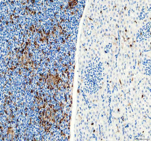 Zebrafish LCP1 Antibody Zebrafish Spleen and Liver IHC. Zebrafish LCP1 Antibody was used for immunohistochemical staining of paraffin-embedded zebrafish spleen (left) and liver (right) tissue sections. Heat-induced epitope retrieval was performed in pH 8 EDTA buffer before incubation with the primary antibody at 2 ug/ml, followed by HRP-conjugated secondary antibody and DAB visualization. Strong immunoreactivity is observed throughout the spleen, while comparatively sparse positive cells are present within the liver, consistent with the enrichment of LCP1 in hematopoietic and immune cell populations. This Zebrafish LCP1 Antibody, an L-Plastin Antibody, is well suited for investigating zebrafish leukocyte distribution, immune cell biology, hematopoiesis, and inflammatory responses.