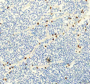 Zebrafish LCP1 Antibody Zebrafish Heart IHC. Zebrafish LCP1 Antibody was used for immunohistochemical staining of paraffin-embedded zebrafish heart tissue. Heat-induced epitope retrieval was performed in pH 8 EDTA buffer before incubation with the primary antibody at 2 ug/ml, followed by HRP-conjugated secondary antibody and DAB visualization. Scattered LCP1-positive cells are observed throughout the cardiac tissue, primarily within the interstitial spaces, consistent with infiltrating or resident leukocytes that express L-Plastin. This Zebrafish LCP1 Antibody, an L-Plastin Antibody, is well suited for investigating zebrafish cardiac immune cell distribution, inflammation, tissue remodeling, and innate immune responses.