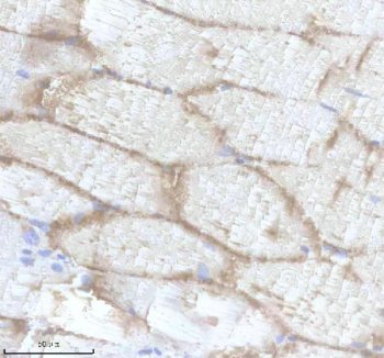 Zebrafish eEF1A Antibody Skeletal Muscle IHC. Immunohistochemistry analysis of EEF1A1A/1B using anti-EEF1A antibody. EEF1A1A/1B was detected in a paraffin-embedded section of zebrafish skeletal muscle tissue. Heat mediated antigen retrieval was performed in EDTA buffer. The tissue section was blocked with 10% goat serum. The tissue section was then incubated with 2 ug/ml rabbit anti-EEF1A1A/1B Antibody overnight at 4oC. Peroxidase Conjugated Goat Anti-rabbit IgG was used as secondary antibody and incubated for 30 minutes at 37oC. The tissue section was developed using DAB as the chromogen.