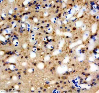 Zebrafish IRF6 Antibody Brain IHC. Immunohistochemical analysis of IRF6 expression was performed using anti-IRF6 antibody in paraffin-embedded zebrafish brain tissue. IRF6, also known as Interferon Regulatory Factor 6, is a transcription factor involved in epithelial differentiation, tissue morphogenesis, and developmental signaling. Moderate cytoplasmic and nuclear staining is observed in neural cells, consistent with the role of IRF6 in regulating gene expression and maintaining tissue homeostasis during vertebrate development. The widespread staining pattern within brain tissue suggests that IRF6 contributes to cellular differentiation and developmental processes beyond its established roles in craniofacial morphogenesis. These results support the utility of Zebrafish IRF6 Antibody for studies of developmental biology, epithelial differentiation, and tissue regeneration. Heat-mediated antigen retrieval was performed in EDTA buffer, and sections were blocked with 10% goat serum before incubation with IRF6 antibody at 2 ug/ml overnight at 4Â°C. Detection was achieved using peroxidase-conjugated goat anti-rabbit IgG and DAB chromogen.