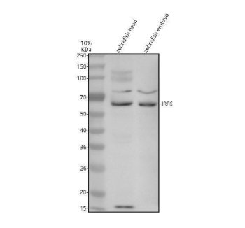 Zebrafish IRF6 Antibody WB. Western blot analysis of IRF6 expression was performed using anti-IRF6 antibody. Electrophoresis was carried out on a 10% SDS-PAGE gel under reducing conditions. Lane 1: zebrafish head tissue lysate. Lane 2: zebrafish embryo tissue lysate. IRF6, also known as Interferon Regulatory Factor 6, is a developmental transcription factor that regulates epithelial differentiation, tissue morphogenesis, and craniofacial development. A specific immunoreactive band is detected at approximately 60 kDa in both samples, close to the expected molecular weight of IRF6 (~55 kDa). Expression in head and embryo lysates is consistent with the important role of IRF6 during embryogenesis and tissue patterning. These results support the utility of Zebrafish IRF6 Antibody for studies of developmental biology, epithelial differentiation, and vertebrate morphogenesis.