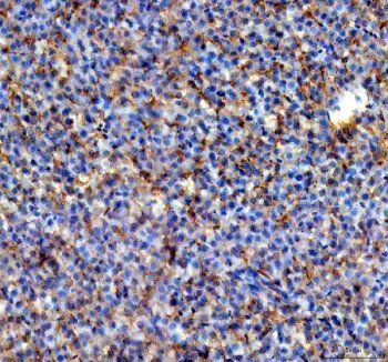 Zebrafish ALDH2 Antibody / ALDH2.1/2.2 Liver IHC. Immunohistochemistry analysis of ALDH2.1,2.2 using anti-ALDH2.1,2.2 antibody. ALDH2.1,2.2 was detected in a paraffin-embedded section of zebrafish liver tissue. Heat mediated antigen retrieval was performed in EDTA buffer. The tissue section was blocked with 10% goat serum. The tissue section was then incubated with 2 ug/ml rabbit anti-ALDH2.1,2.2 Antibody overnight at 4oC. Peroxidase Conjugated Goat Anti-rabbit IgG was used as secondary antibody and incubated for 30 minutes at 37oC. The tissue section was developed using DAB as the chromogen.