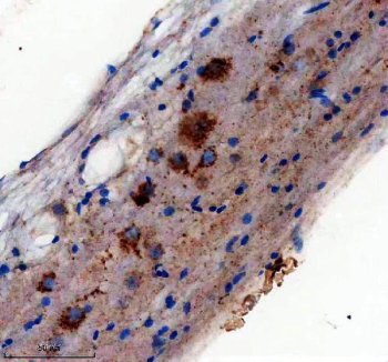 Zebrafish DCP2 Antibody Spinal Cord IHC. Immunohistochemical analysis of DCP2 expression was performed using anti-DCP2 antibody in paraffin-embedded zebrafish spinal cord tissue. DCP2, also known as mRNA Decapping Enzyme 2, is the catalytic component of the mRNA decapping complex that initiates 5â²-to-3â² mRNA degradation and regulates post-transcriptional gene expression. Cytoplasmic staining is observed throughout spinal cord cells, consistent with the localization of DCP2 within cytoplasmic processing bodies (P-bodies) where mRNA turnover and RNA quality control occur. The staining pattern supports the essential role of DCP2 in regulating transcript stability during neural development and maintaining cellular RNA homeostasis. These results support the utility of Zebrafish DCP2 Antibody for studies of RNA metabolism, post-transcriptional gene regulation, and vertebrate development. Heat-mediated antigen retrieval was performed in EDTA buffer, followed by incubation with DCP2 antibody at 2 ug/ml overnight at 4Â°C. Detection was achieved using a peroxidase-conjugated goat anti-rabbit IgG secondary antibody and DAB chromogen.