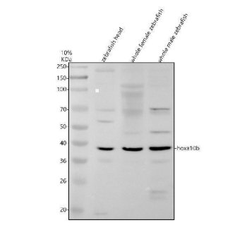 Zebrafish HOXA10 Antibody WB. Western blot analysis of HOXA10 expression was performed using anti-HOXA10B antibody. Electrophoresis was carried out on a 10% SDS-PAGE gel under reducing conditions. Lane 1: zebrafish head tissue lysate. Lane 2: whole female zebrafish tissue lysate. Lane 3: whole male zebrafish tissue lysate. HOXA10B is a zebrafish ortholog of the mammalian HOXA10 homeobox transcription factor that regulates embryonic patterning, tissue specification, and anterior-posterior body axis development. A specific immunoreactive band is detected at approximately 37 kDa in all three samples, corresponding to the expected molecular weight of HOXA10B. The consistent expression across head and whole-body lysates supports the widespread developmental role of HOXA10B in regulating transcriptional programs required for vertebrate morphogenesis. These results demonstrate the utility of Zebrafish HOXA10 Antibody for studies of developmental biology, HOX gene function, embryonic patterning, and transcriptional regulation.