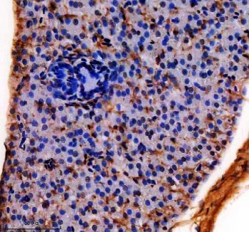 Zebrafish HOXA3 Antibody Liver IHC. Immunohistochemical analysis of HOXA3 expression was performed using anti-HOXA3A antibody in paraffin-embedded zebrafish liver tissue. HOXA3A is a zebrafish ortholog of the mammalian HOXA3 homeobox transcription factor that regulates embryonic patterning, tissue specification, and developmental gene expression. Moderate nuclear and cytoplasmic staining is observed in hepatocytes, consistent with the role of HOXA3A in controlling developmental transcriptional programs and maintaining tissue-specific gene expression. Although HOXA3 is best known for its functions during embryogenesis, continued expression in adult tissues supports roles in cellular differentiation and tissue homeostasis. These results demonstrate the utility of Zebrafish HOXA3 Antibody for studies of developmental biology, transcriptional regulation, vertebrate morphogenesis, and HOX gene function. Heat-mediated antigen retrieval was performed in EDTA buffer, followed by incubation with HOXA3A antibody at 2 ug/ml overnight at 4Â°C. Detection was achieved using a peroxidase-conjugated goat anti-rabbit IgG secondary antibody and DAB chromogen.