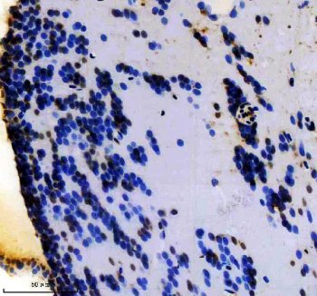 Zebrafish HOXA3 Antibody Brain IHC. Immunohistochemical analysis of HOXA3 expression was performed using anti-HOXA3A antibody in paraffin-embedded zebrafish brain tissue. HOXA3A is a zebrafish ortholog of the mammalian HOXA3 homeobox transcription factor that regulates embryonic patterning, tissue specification, and developmental gene expression. Nuclear staining is observed in scattered neural cells, consistent with the function of HOXA3A as a DNA-binding transcription factor that controls developmental transcriptional programs. Expression within the nervous system supports the established role of HOX proteins in vertebrate neural development, regional identity, and maintenance of differentiated cell populations. These results demonstrate the utility of Zebrafish HOXA3 Antibody for studies of developmental biology, neurodevelopment, transcriptional regulation, and HOX gene function. Heat-mediated antigen retrieval was performed in EDTA buffer, followed by incubation with HOXA3A antibody at 2 ug/ml overnight at 4Â°C. Detection was achieved using a peroxidase-conjugated goat anti-rabbit IgG secondary antibody and DAB chromogen.