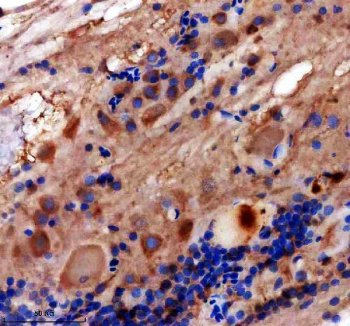 Zebrafish NKX2.1 Antibody / Thyroid Transcription Factor 1 Antibody Zebrafish Spinal Cord IHC. Immunohistochemical staining of paraffin-embedded zebrafish spinal cord tissue using Zebrafish NKX2.1 Antibody / Thyroid Transcription Factor 1 Antibody. NKX2.1 expression is detected predominantly within the nuclei of spinal cord cells, consistent with its function as a homeobox transcription factor regulating neuronal specification, central nervous system development, and transcriptional control during vertebrate embryogenesis. Heat-induced epitope retrieval was performed using EDTA buffer prior to immunostaining with DAB chromogenic detection.