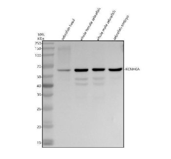 Zebrafish Catalase Antibody Zebrafish Head, Female, Male and Embryo WB. Western blot analysis of 1) zebrafish head, 2) whole female zebrafish, 3) whole male zebrafish, and 4) zebrafish embryo tissue lysates using Zebrafish Catalase Antibody. A distinct immunoreactive band is detected at approximately 59 kDa in all four samples, consistent with the predicted molecular weight of catalase. The observed molecular weight matches the expected size of approximately 59 kDa, supporting specific detection of the endogenous antioxidant enzyme. Proteins were separated under reducing conditions, transferred to a nitrocellulose membrane, and detected following incubation with the primary antibody (0.5 ug/ml) and an HRP-conjugated goat anti-rabbit secondary antibody using ECL detection.
