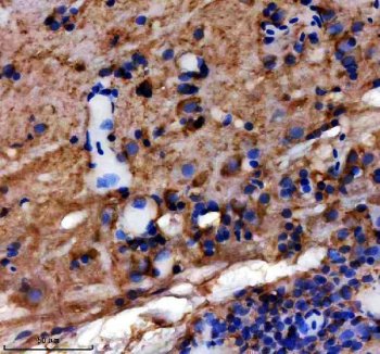 Zebrafish Vimentin Antibody / VIM Antibody Zebrafish Brain IHC. Immunohistochemical staining of paraffin-embedded zebrafish brain tissue using Zebrafish Vimentin Antibody / VIM Antibody. Vimentin expression is detected predominantly within the cytoplasm of neural support and mesenchymal-associated cells, consistent with its role as a type III intermediate filament protein involved in cytoskeletal organization, tissue development, and cellular remodeling. Heat-induced epitope retrieval was performed in EDTA buffer prior to staining. Tissue sections were blocked with 10% goat serum and incubated with the primary antibody (2 ug/ml) overnight at 4Â°C, followed by an HRP-conjugated goat anti-rabbit secondary antibody and DAB chromogen for visualization.