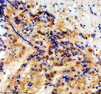Zebrafish FZD8 Antibody / Frizzled 8A Antibody Zebrafish Brain IHC. Immunohistochemical staining of paraffin-embedded zebrafish brain tissue using Zebrafish FZD8 Antibody / Frizzled 8A Antibody. FZD8A expression is detected predominantly within the cytoplasm of neural cells, consistent with its role as a Frizzled family receptor that mediates Wnt signaling during nervous system development, tissue patterning, and cell fate determination. Heat-induced epitope retrieval was performed in EDTA buffer prior to staining. Tissue sections were blocked with 10% goat serum and incubated with the primary antibody (2 ug/ml) overnight at 4Â°C, followed by an HRP-conjugated goat anti-rabbit secondary antibody and DAB chromogen for visualization.
