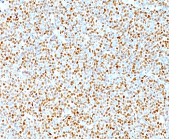 Cyclin D1 antibody immunohistochemistry