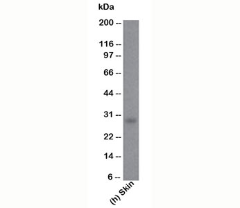 Western blot testing of human samples using Bcl-2 antibody (100/D5).