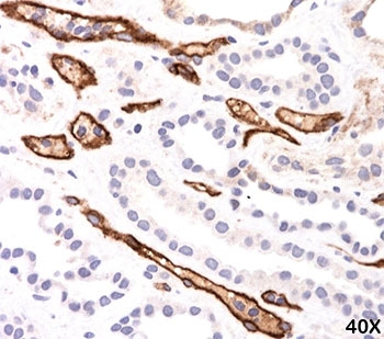 IHC testing of FFPE human kidney transplant tissue (40X) stained with Complement 4d / C4d antibody (C4D204).