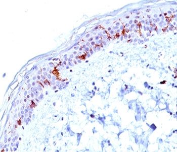 CD1A Antibody Clone O10. Immunohistochemistry analysis of CD1A / CD1a expression in human skin tissue using CD1A Antibody Clone O10. Strong membranous and cytoplasmic staining is observed in dendritic cells within the epidermis, consistent with Langerhans cell localization, while surrounding keratinocytes remain largely negative. The staining pattern highlights tissue-resident antigen-presenting cells within the epithelial layer and reflects the established use of clone O10 for detecting CD1a-positive dendritic cells in skin.