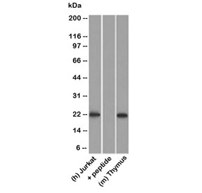 CD3e Antibody for WB. Western blot analysis of CD3 Epsilon / CD3E antibody in lysates using CD3e Antibody for WB / CD3 Epsilon Western Blot Antibody. Lane 1: human Jurkat cell lysate, Lane 2: human Jurkat lysate pre-incubated with immunizing peptide, Lane 3: mouse thymus lysate. A band is detected at approximately 20-25 kDa in Jurkat and thymus samples, consistent with the predicted molecular weight of CD3 epsilon. Signal is specifically reduced in the peptide-blocked condition, supporting target specificity of the antibody. The presence of a clear band in both human and mouse T-cell-rich samples aligns with the known expression of CD3 epsilon in lymphoid tissues.
