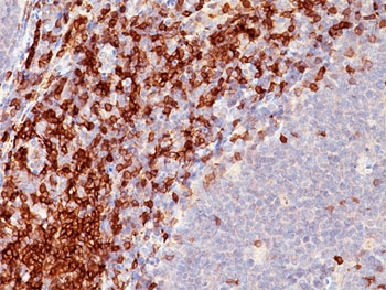 CD5 Antibody for IHC. Immunohistochemistry analysis of CD5 antibody staining in human tonsil tissue using an immune cell communication marker antibody, clone C5/473. Strong membranous staining is observed in interfollicular T lymphocytes with dense labeling of T cell zones adjacent to germinal centers, while follicular B cell regions remain largely negative. The staining pattern highlights lymphoid architecture and reflects the role of CD5 in mediating immune cell interactions and signaling at sites of lymphocyte communication.