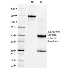 SDS-PAGE analysis of purified, BSA-free CD5 Antibody Clone CRIS-1 / Immune Checkpoint-Associated Marker Antibody as confirmation of integrity and purity.