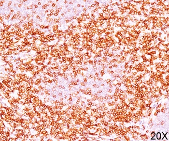 IHC testing of human tonsil (10X) stained with CD6 antibody (clone C6/372).