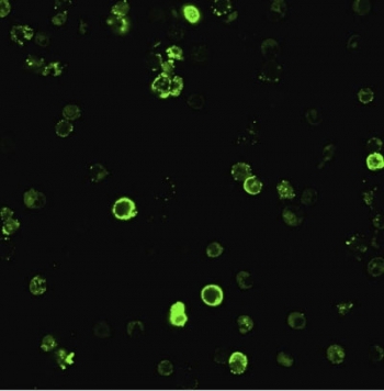 CD8A Antibody for IF. Immunofluorescence analysis of CD8 alpha (CD8A) in human PBMC showing strong membrane-associated green fluorescence in cytotoxic T lymphocytes, consistent with cell surface localization and enabling visualization of CD8-positive immune cell populations within heterogeneous peripheral blood mononuclear cell samples (clone C8/468).