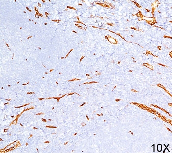 CD34 Antibody Tonsil IHC QBEnd/10. Immunohistochemistry analysis of CD34 expression in FFPE human tonsil (10X) using an Extracellular Domain Endothelial Marker Antibody, clone QBEnd/10, demonstrates strong membranous HRP-DAB brown staining in vascular endothelial cells outlining small vessels and capillary networks within lymphoid tissue, while surrounding lymphocytes remain largely negative. The staining pattern highlights well-defined endothelial-lined structures and supports clear visualization of vascular architecture in tonsil.