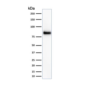 HCAM Antibody Human HeLa Cell Line WB. Western blot analysis of HCAM / CD44 expression in human HeLa cell lysate using mouse monoclonal antibody clone 156-3C11. A band is detected at approximately 80 kDa, consistent with the predicted molecular weight of HCAM/CD44 (HCAM / CD44 antigen). CD44 is a glycosylated transmembrane protein, and the observed band reflects the core protein with potential variation in apparent molecular weight due to glycosylation of the extracellular domain. The detected signal supports HCAM/CD44 expression in HeLa cells and is consistent with its role as a cell surface adhesion molecule.