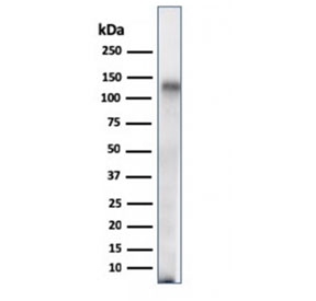 Western blot testing of human spleen lysate with CD68 antibody (clone C68/684). Expected molecular weight: 37-110 kDa depending on glycosylation level.