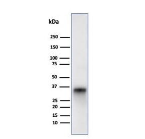 Western blot testing of human Raji cell lysate with CD74 antibody (clone LN-2). Expected molecular weight: 33-43 kDa.