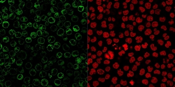 Immunofluorescent staining of PFA-fixed human Raji cells with CD79a antibody cocktail (clone JCB117 + HM47/A9, green) and Reddot nuclear stain (red).
