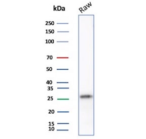 Western blot testing of mouse RAW264.7 cell lysate with p27Kip1 antibody. Expected molecular weight ~27 kDa.