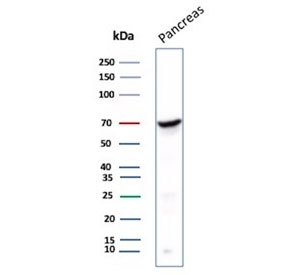 Chromogranin A Antibody Pancreas WB. Western blot testing of human pancreas tissue lysate with Chromogranin A antibody. Predicted molecular weight ~50 kDa but may be observed at higher molecular weights due to glycosylation.