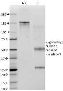 SDS-PAGE Analysis of Purified, BSA-Free CD35 Antibody (clone E11). Confirmation of Integrity and Purity of the Antibody.