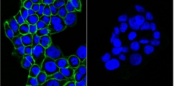 EGFR Antibody CF488 Conjugate IF. Left: Immunofluorescent staining of human A431 cells with CF488-conjugated EGFR antibody (clone GFR450, green) and DAPI nuclear stain (blue). Right: isotype control.