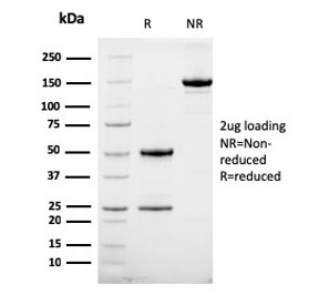 SDS-PAGE Analysis of Purified, BSA-Free ErbB2 Antibody (clone HRB2/258). Confirmation of Integrity and Purity of the Antibody.