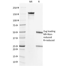 SDS-PAGE analysis of purified, BSA-free HER2 / ErbB2 antibody (clone HRB2/718) as confirmation of integrity and purity.