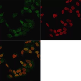 Estrogen Receptor alpha Antibody CF488 Conjugate IF. Immunofluorescent staining of methanol-fixed human MCF7 cells with Estrogen Receptor alpha Antibody CF488 conjugate (clone ER506, green) and Reddot nuclear stain (red).