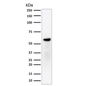Estrogen Receptor beta Antibody Breast Cancer Cell Line WB. Western blot testing of human MCF7 cell lysate with Estrogen Receptor beta antibody (clone ERb455). Expected molecular weight: 53-59 kDa.