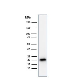 Melan-A Antibody COLO-38 Cell Line WB. Western blot analysis of human COLO-38 cell lysate using clone A103. A strong band is detected near approximately 18-20 kDa, consistent with the expected molecular weight range of Melan-A / MLANA/MART-1, a melanocyte lineage-associated protein involved in melanosome biology and melanoma differentiation pathways. A possible closely migrating doublet may reflect alternatively processed or post-translationally modified Melan-A-associated protein species commonly observed in melanocytic tumor cell lines.