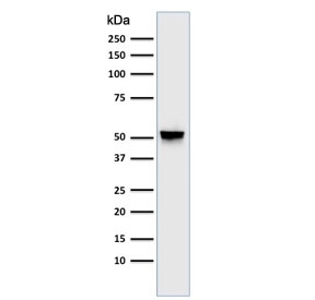 Western blot testing of human brain lysate GFAP antibody (clone GA-5). Predicted molecular weight ~50 kDa.