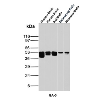 GFAP Antibody Brain Tissue WB. Western blot analysis of human brain, mouse brain, rat brain, guinea pig brain, and hamster brain tissue lysates using GFAP Antibody clone GA-5. Strong bands are detected at approximately 50 kDa across multiple mammalian brain samples, consistent with the predicted molecular weight of Glial fibrillary acidic protein / GFAP, a major astrocytic intermediate filament protein involved in cytoskeletal organization and maintenance of neural tissue integrity. The observed cross-species reactivity pattern is consistent with the highly conserved expression of GFAP within central nervous system glial populations.