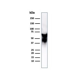 Western blot testing of Hep-2 cell lysate with HSP60 antibody (clone LK2).