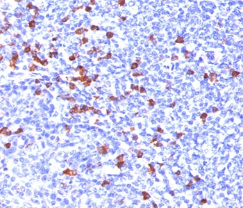 IHC testing of human tonsil stained with anti-IgG antibody (IG266). HIER: boil tissue sections in 10mM citrate buffer, pH 6, for 10-20 min and allow to cool before testing.