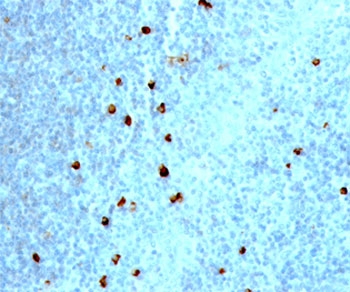 IHC testing of human tonsil stained with IgM heavy chain antibody (clone IM373).