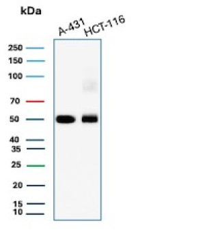 Western blot analysis of human A431 and HCT-116 cell lysates using Cytokeratin 8 Antibody TS1.