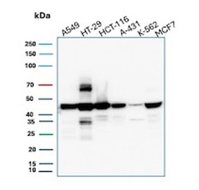 Western blot testing of human tumor cell lysates using Cytokeratin 18 antibody (clone DC10). Predicted molecular weight ~48 kDa.
