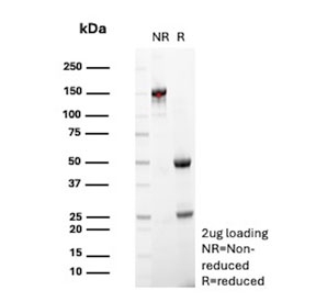 SDS-PAGE analysis of purified, BSA-free MUC18 antibody (clone OJ79c) as confirmation of integrity and purity.