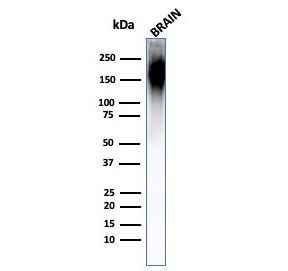 Western blot testing of human brain lysate with Neurofilament antibody (clone NF421).